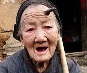 У 101 летней жительницы Китая вырос рог
